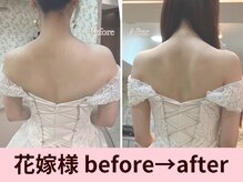 クイーンズチャーム(Queen's Charm)/最強のブライダルエステ★