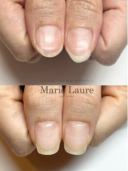 マリーロール 淀屋橋本店(Marie Laure)/自爪育成/深爪矯正/ネイルケア