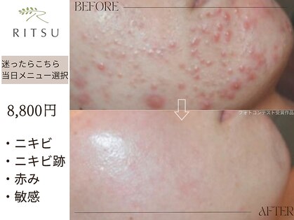 リツ(Ritsu)の写真