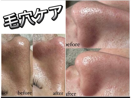 ラニー アンド ココネイル(LANIE&CocoNail)の写真