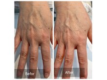 ロア ネイル アンド(loa nail and ...)の雰囲気（乾燥くすみに美容成分導入で年齢を感じないふっくらお手元へ）