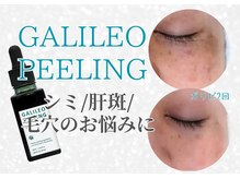 SNSで話題☆【強炭酸×ピーリング】でお肌まるっとキレイに！