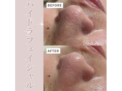 ベル(Belle)の写真