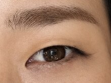 シェリー(Cherie)/before