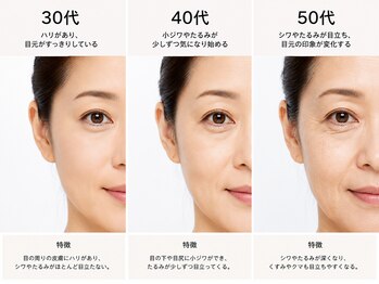 マウレア 山形店(Maulea)/年齢とともに進む目元の変化
