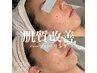 【剥けないハーブピーリング】毛穴引き締め/毛穴黒ずみ/(毛穴吸引付き)