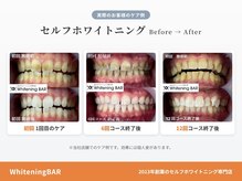 ホワイトニングバー 名古屋栄店