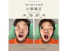リボーンプラス