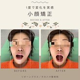リボーンプラス