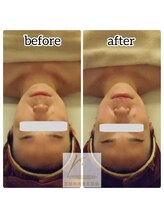 せせら 代々木上原店/3D最強造顔　ミネラル石膏パック