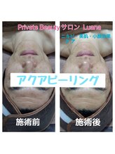 ルアナ(Luana)/メンズも美肌に(^-^)v