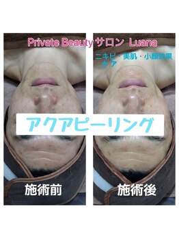 ルアナ(Luana)/メンズも美肌に(^-^)v