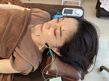 ハリファ鍼灸院 横浜関内院(HariFa鍼灸院)/美容施術