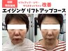 【40代以上オススメ！】リフトアップコース　40分￥16,300→￥11,880