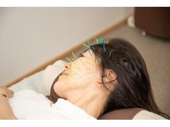 北梅田美容鍼灸院/【大阪/梅田】美容鍼灸