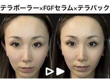 エクレクティック(ECLECTIC)/小顔/小顔整体/宇都宮エステ