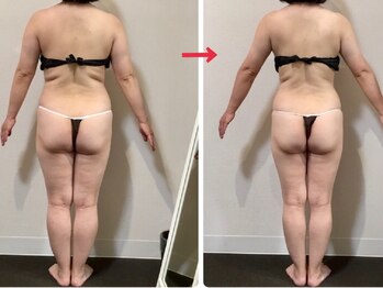 オージャス(OJAS)/40代○○様の変化 痩ボディーへ