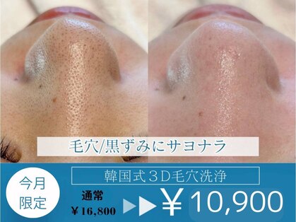 ラデュープラス(Radieux+)の写真