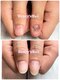 ハニーズネイル(Honey's Nail)の写真/深爪,巻き爪矯正歴10年以上の老舗店☆《深爪矯正》長さ出し+ジェル仕上げ12960円～！フット深爪13960円
