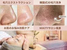 ミキティ(MIKITY)の雰囲気（様々な肌に対応して改善していきます）