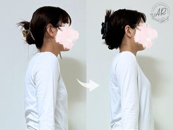 エーアール(AR)の写真/骨格リセットで肩甲骨をまるっと解放★今度こそ繰り返す首肩こり・猫背・巻き肩を根本解消しませんか?!