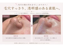 ビドウ(BIDOU)の雰囲気（毛穴洗浄×wax脱毛で、つるんと透明感。）