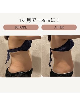 サロン ド リア(salon de Lia)/痩身1か月で-8センチ