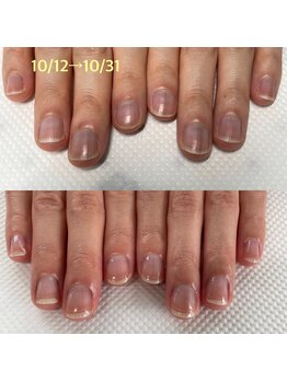 血色の良い健康的なお爪へ