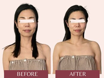 アンリール(Anrire)/【板橋/フェイシャルエステ】