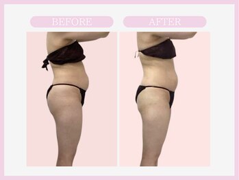 アコガレコガオ 盛岡店/