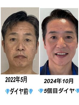 ビューティスタジオＫ/ダイヤモンドピールで上質な肌へ