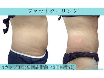 リメイク 広尾(REMAKE)/