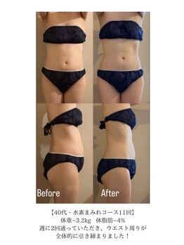 ヨサパーク サンテ 祐天寺(YOSA PARK sante)/痩身/ダイエット/よもぎ蒸し痩身