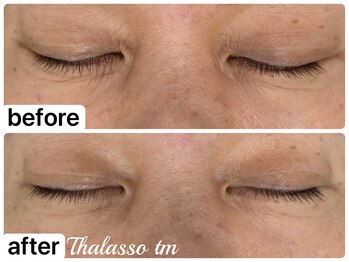 アール(R)/【タラソトリートメント】