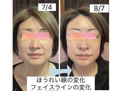 クマ ハウス(KUMA HOUSE)の写真
