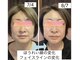 クマ ハウス(KUMA HOUSE)の写真