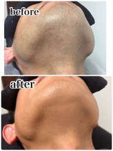 エアリアル 中津店/アゴ髭