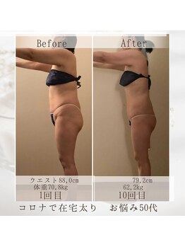 フローラ 自由が丘(Flora)/痩身に年齢関係なし