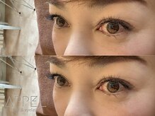 アペル(APPEL)/二重さん大人気【岡山/岡山駅】