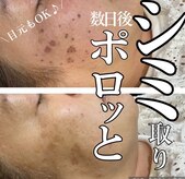 ルリアン(Le lien)