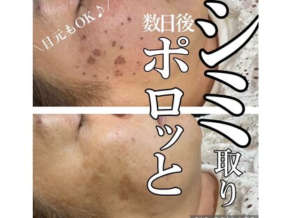 ルリアン(Le lien)の写真