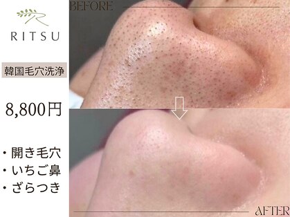 リツ(Ritsu)の写真