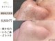 リツ(Ritsu)の写真