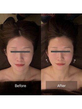 グレースフィオーレ 豊田店(gracefiore)/ビフォーアフター