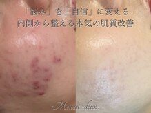 モナートドゥ(Monartdeux)