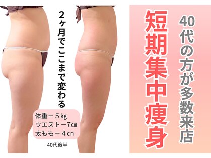 エルナ(Eluna)の写真