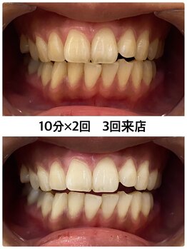 エム(M)/変化写真