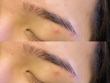 アイクイック 原宿(Ai Quick)/メンズアイブロウワックス脱毛