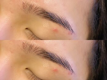 アイクイック 原宿(Ai Quick)/メンズアイブロウワックス脱毛