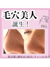 フィールカブ 仙川(feel kab)/長年の悩みも一度でこの変化☆